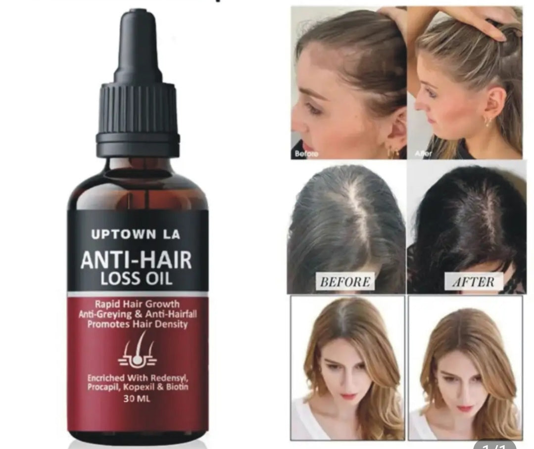 Anti Hair Loss Hair Regrowth oil 30 ml Mix Bazar
