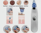 Derma Suction Blackhead Remover - 3-in-1 Vacuum Pore Cleaner for Acne & Pimples - Mix Bazar - Mix Bazar