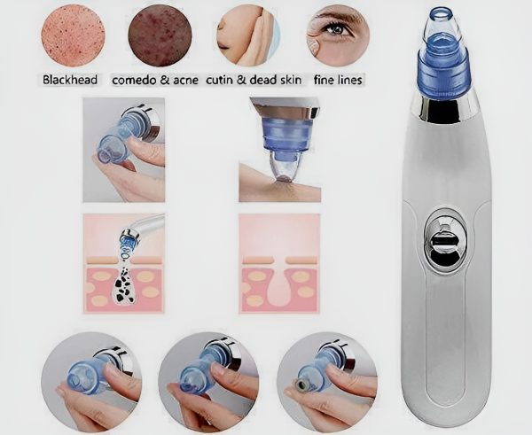 Derma Suction Blackheads and acne Remover